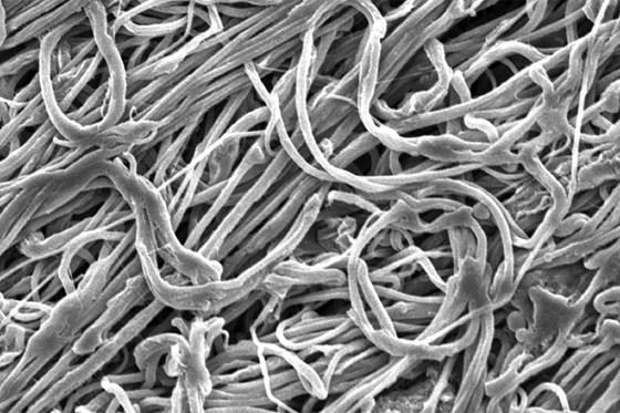 MIT’s new ultrafine fibers are made via gel electrospinning of polyethylene. 